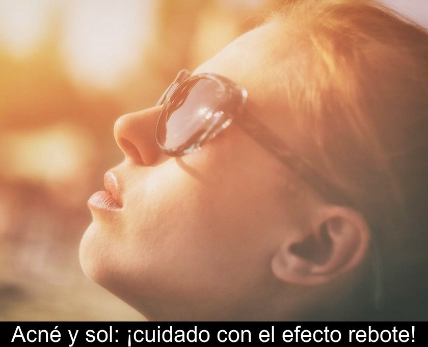 Acné Y Sol: ¡cuidado Con El Efecto Rebote!