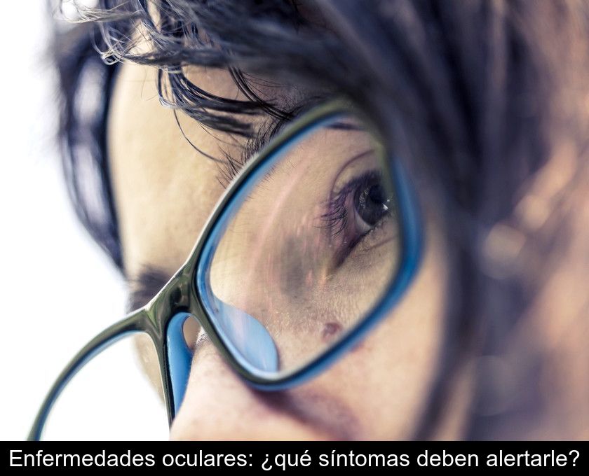 Enfermedades Oculares: ¿qué Síntomas Deben Alertarle?