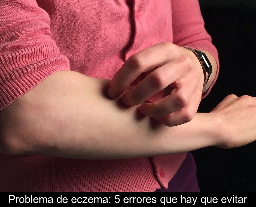 Problema De Eczema: 5 Errores Que Hay Que Evitar