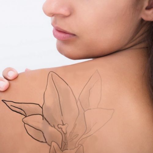 Medicina estética: eliminación de tatuajes con láser en 5 preguntas.